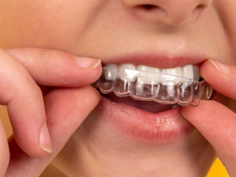 dental teeth whitening in Nairobi