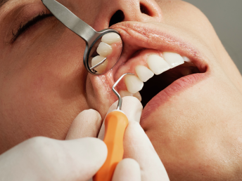 teeth whitening in Nairobi